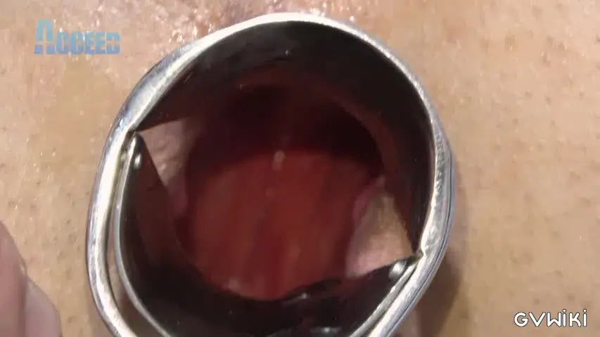Orgasm~ドMデカマラ少年・斗吏 尿道プレイにデカマラビンビン!アナルも拡張されて中出し種付け!!~-10